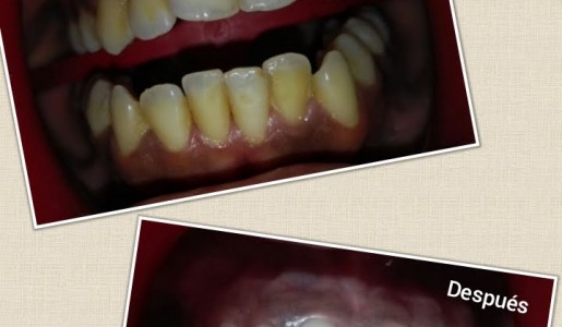 Imgen: SERVICIO: Atencin odontolgica:ortodoncia, odontopediatria, endodoncia, implantolog dental, 