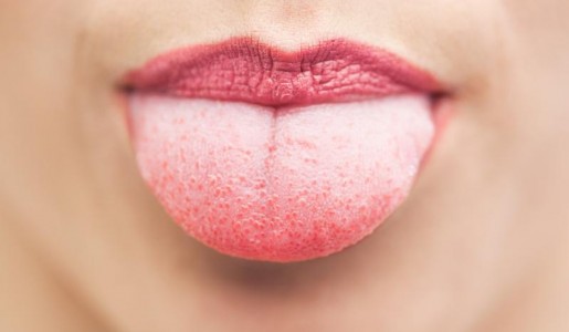 Cmo curar una quemadura en la lengua