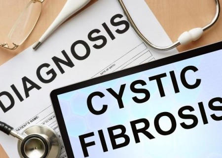 Cmo tratar la fibrosis qustica