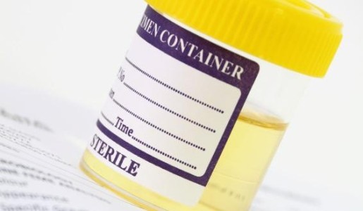 Por qué tengo el ácido úrico alto