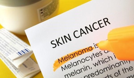 Causas del cáncer de piel