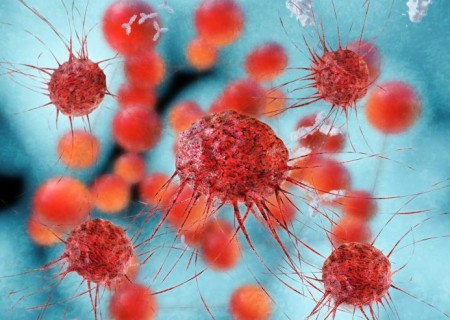 ¿Se puede curar la metástasis?