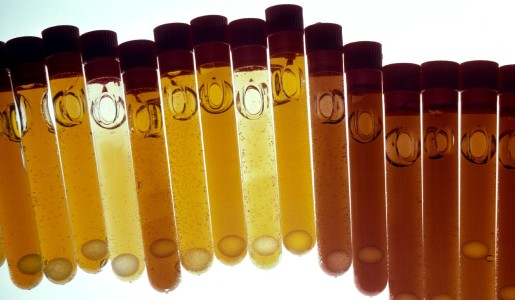 Por qué tengo el hematocrito alto