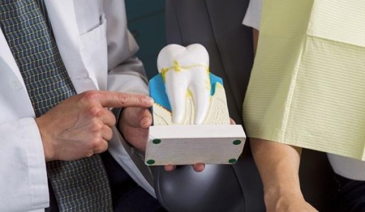 Causas de la periodontitis