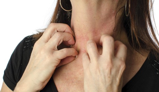 Remedios caseros para curar el sarpullido