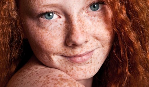 Mascarillas para aclarar las pecas