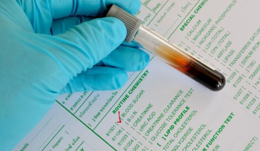 Por qué tengo la glucosa baja