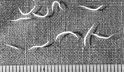 Remedios caseros para eliminar parásitos intestinales