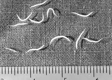 Remedios caseros para eliminar parásitos intestinales