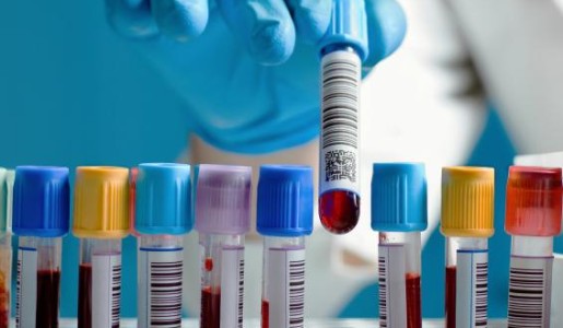 Por qué tengo el hematocrito bajo