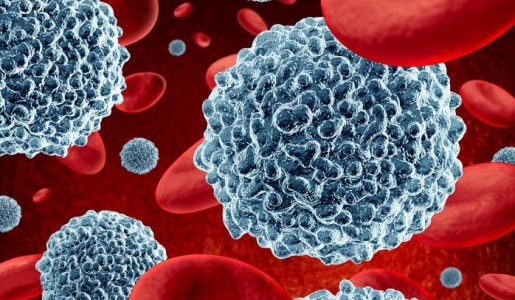 Cómo tratar la anisocitosis