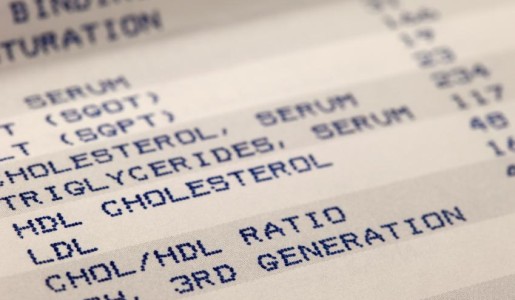 Por qué tengo los triglicéridos altos