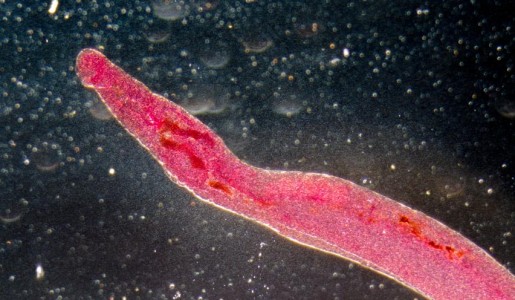 Síntomas de la parasitosis